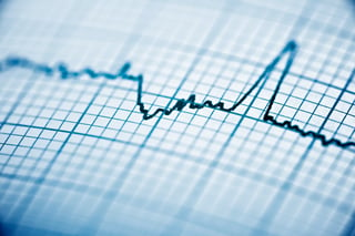 Healthcare - Electrocardiogram Paper